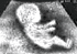 Ultrasound Scan Luv speed