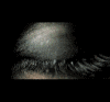 dark eye